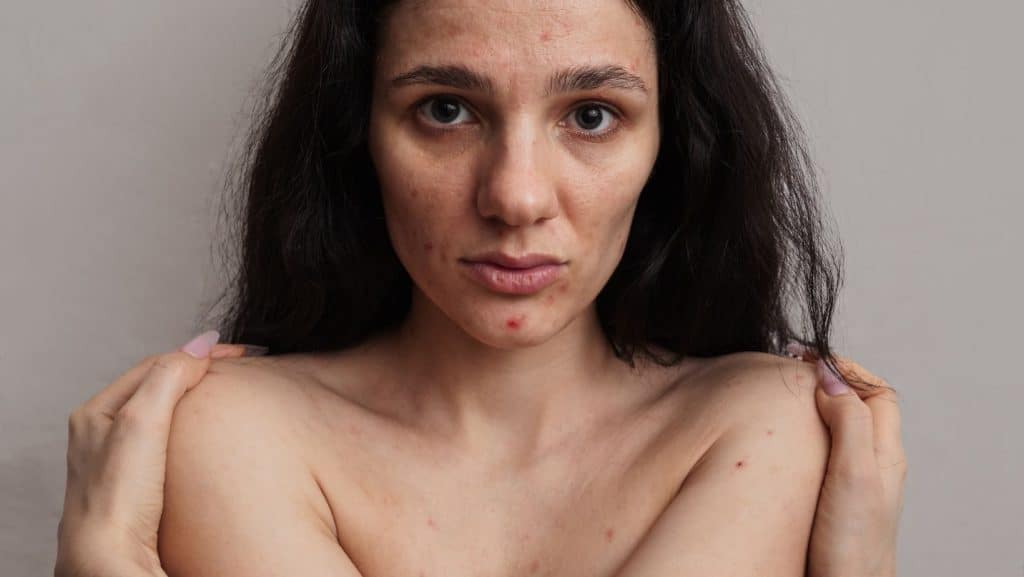 Autoestima inseguridad Psicologo